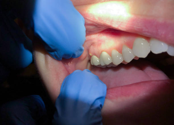 Best Same-Day Emergency Dental Services in Lake Worth, TX