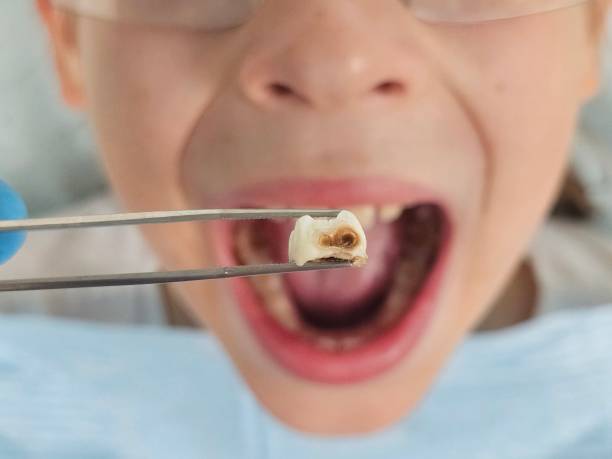 Best Same-Day Emergency Dental Services in Lake Worth, TX